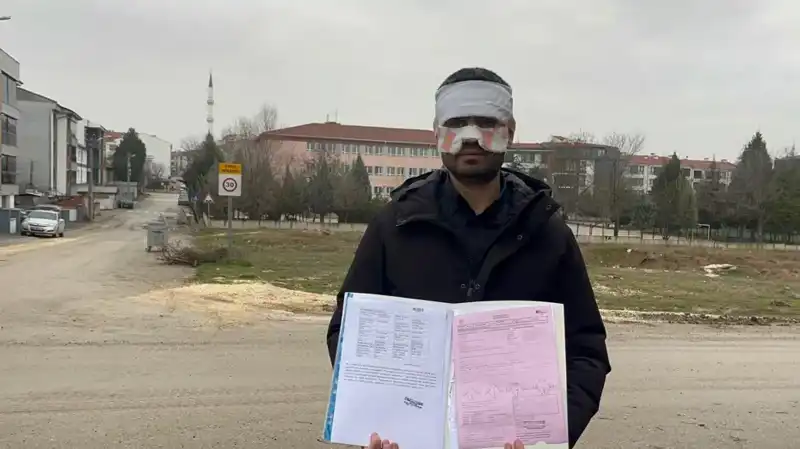 Öğretmenler Arasında Yaşanan İlginç Olay: Yüzüne Sıcak Çay Fırlatıldı